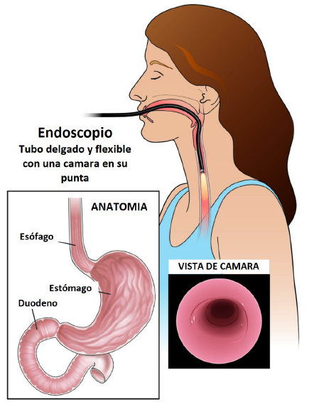 endoscopia-que-es